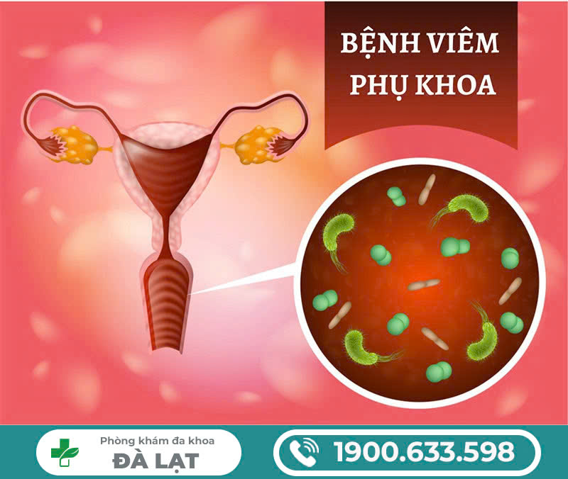 Hình ảnh minh họa